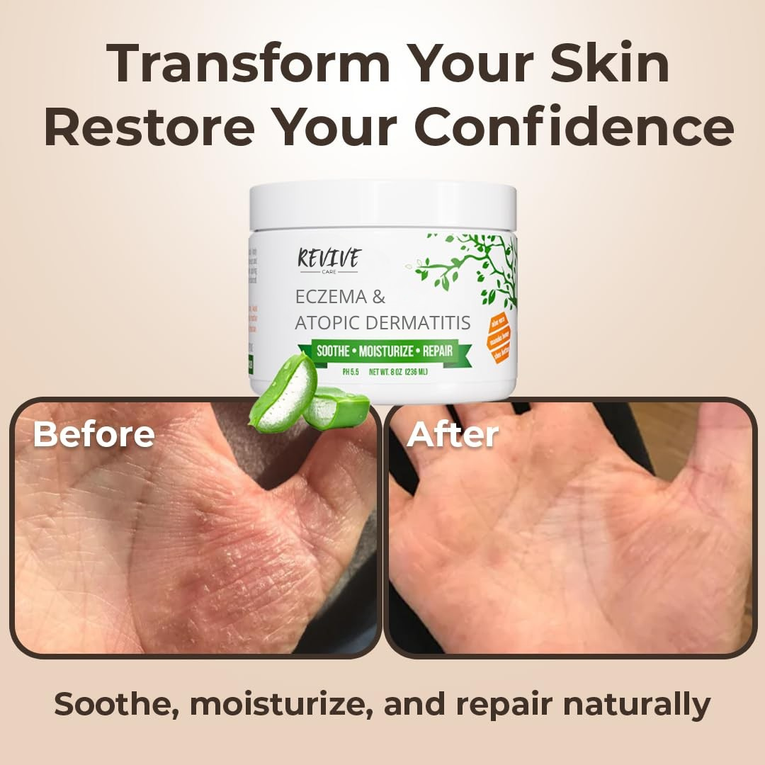 Atopic Dermatitis Recovery Kit