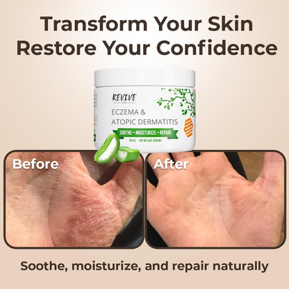 Atopic Dermatitis Recovery Kit