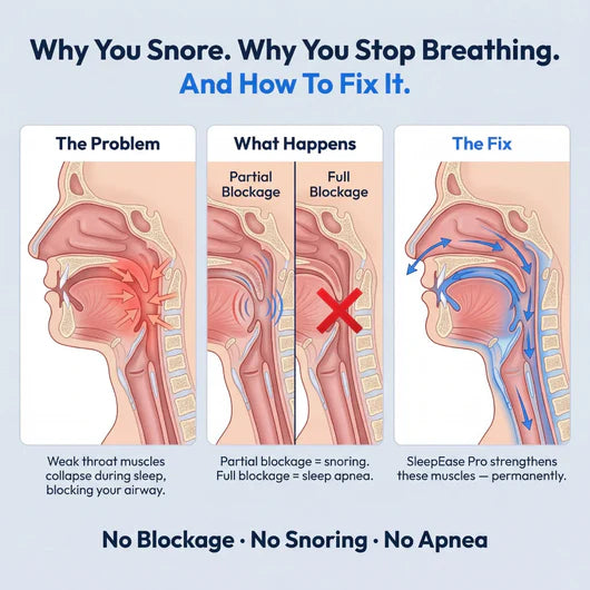 Revive Care SleepEase Pro — Eliminates Snoring & Sleep Apnoea